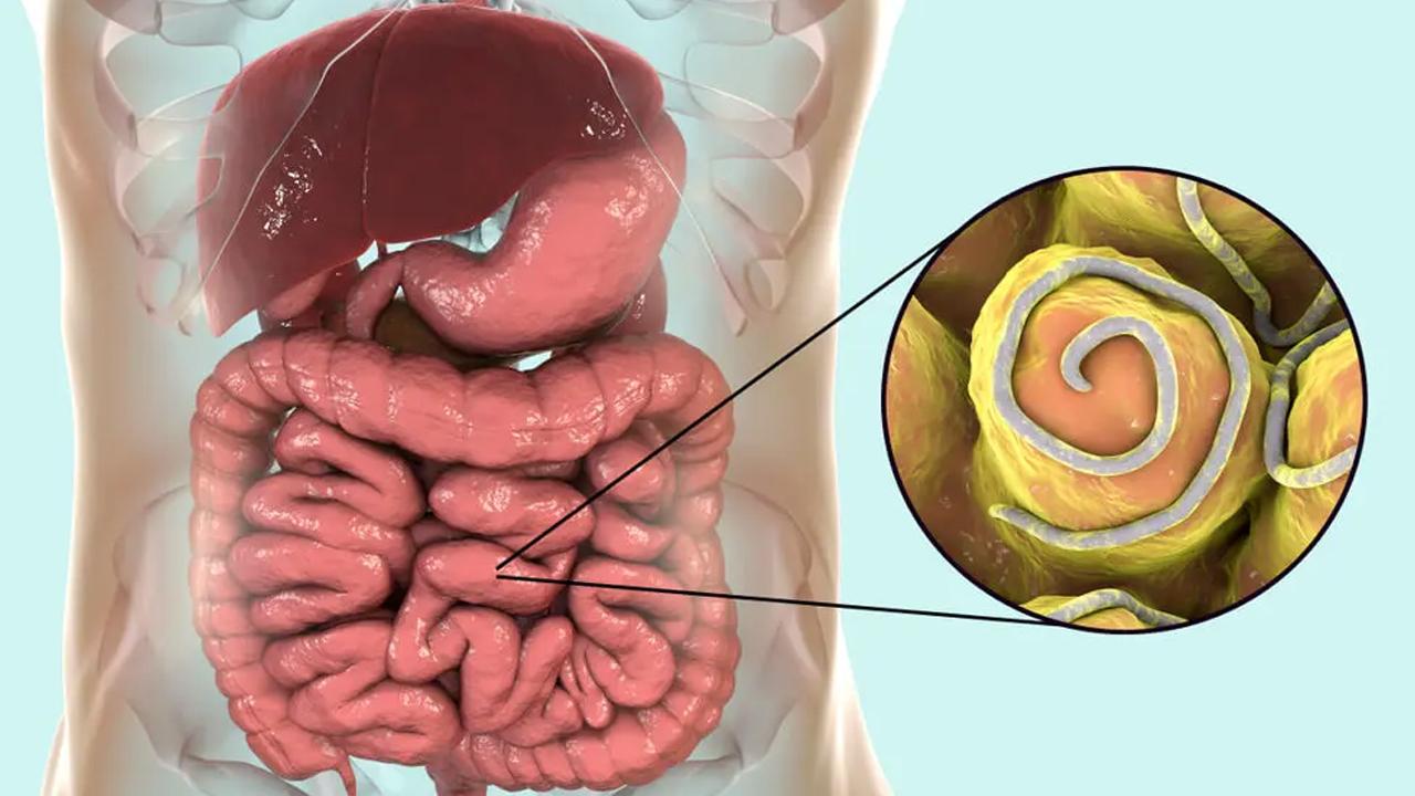 Kıl kurdu nasıl dökülür? Yetişkinlerde kıl kurdu bulaşıcı mı?